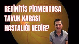 Retinitis Pigmentosa -Tavuk Karası hastalığı nedir, tedavisi var mı? Aktivist Öznur Kırman anlatıyor