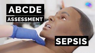 ABCDE Assessment | Sepsis | Emergency Simulation Scenario | OSCE Guide | UKMLA | CPSA