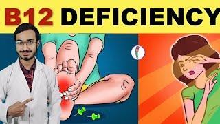 Vitamin B12 rich Foods | Vitamin B12 Deficiency | Vitamin B12 Diet | All You Need To Know About B12