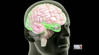 Football players and brain injuries