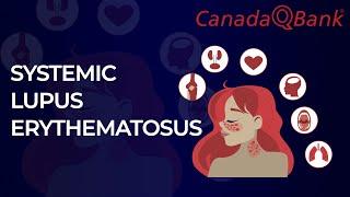 Systemic Lupus Erythematosus (SLE)