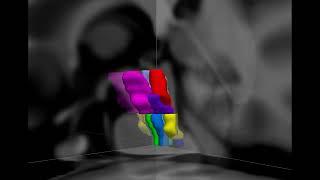 Brainstem nodes of the default ascending arousal network (dAAN)