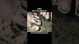 【每天一个新知识】士兵长时间站在水里就会形成战壕足 #冷知识 #科普 #涨知识