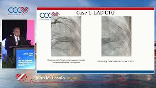 John M  Lasala, MD, PhD   Atherectomy is a Must! Severely Calcified Lesions