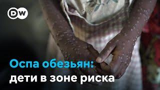 ВОЗ бьет тревогу: новый опасный штамм оспы обезьян мутирует и поражает детей