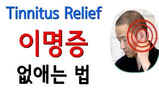 이명치료 이명증상 치료법 19가지 귀에서 삐소리 이명 귀지압 이명에좋은 운동 Tinnitus relief exercise Acupressure points