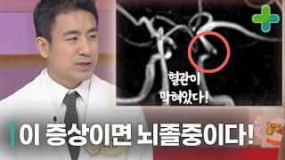 꼭 알아두어야 할 뇌졸중 전조 증상