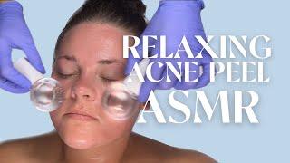 FACE REALITY ACNE PEEL ASMR