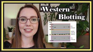 Western Blotting  |  Beginner Data Interpretation Tutorial & Step-by-Step Protocol Explained