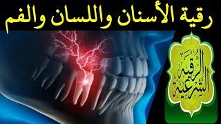 رقية الأسنان واللسان،رقية وجع الأسنان،رقية لعلاج الاسنان،رقية شرعية للفم من العين والسحر والمس