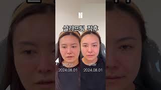 땅콩형 얼굴 하루만에 해결하는법