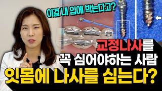 내 잇몸에 나사를 박아야한다고?! 교정나사를 꼭 박아야하는 사람과 교정나사를 뽑는 시기까지!ㅣ 미니 스크류의 모든 것