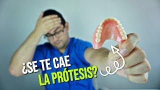 ¿TU PRÓTESIS DENTAL SE MUEVE? ¡Deberías ver este vídeo!