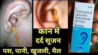 Earwel Ear Drops uses side effects in hindi, earwel ear drop use hindi