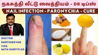 நகசுத்தி வந்தால் குணமாக வீட்டு வைத்தியம்|nail skin infection home remedies paronychia dr karthikeyan