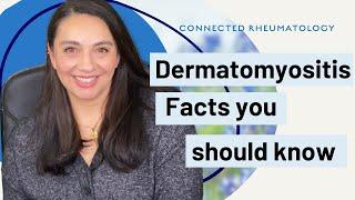 Dermatomyositis Facts your Rheumatologist wants you to know