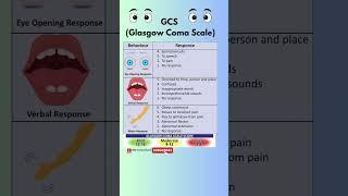 GCS Score | Glasgow Coma Scale | GCS Score Assessment #gcs #GCS Scale #medical #ytshorts