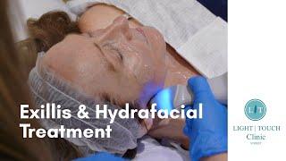 Exillis & Hydrafacial Treatment at Light Touch Clinic Surrey