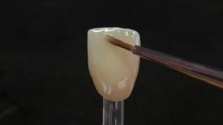 CZR FC Paste Stain: applicazione su denti anteriori