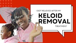 Laser Keloid Removal Kenya | 13Yrs Old Girl Says Goodbye to Keloids Thanks  to Our Help | Unfiltered