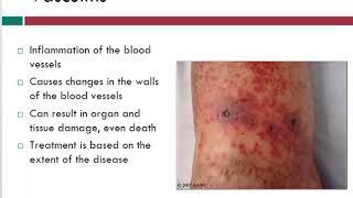 Vasculitis | Info About Vein Problems | WoundEducators.com