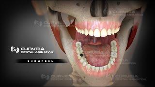 3D Dental Animation |  S H O W R E E L | Curveia Dental Animation