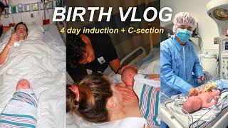 BIRTH VLOG *RAW*  4 day induction ending in emergency C-section | IVF live birth