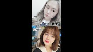 자연주의성형외과 눈재수술+코성형+얼굴지방이식 수술 전후영상