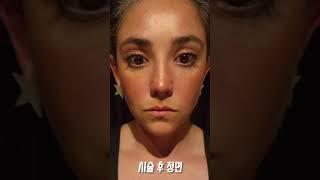 해외 의사들까지 금손의사를 찾아오는 이유