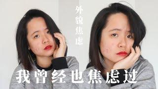 「外貌焦虑」曾经因为脸上的瑕疵 对自己的外貌产生自卑....｜学历焦虑、身材焦虑、