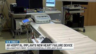 NEA Baptist becomes first in Arkansas to implant new heart failure device