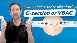 If you have C-section or VBAC,  YOU NEED THIS #csection #vbacks