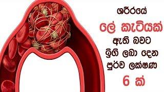 ශරීරයේ ලේ කැටියක් ඇති බවට ඉඟි ලබා දෙන පුර්ව ලක්ෂණ 6 ක්