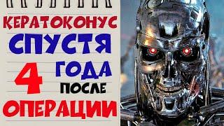  КЕРАТОКОНУС ‍️ Спустя 4 ГОДА после кератотомии в клинике Арцыбашева в Будапеште 