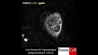 E.coli devoured by human Macrophage