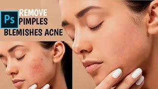 Remove pimples, Blemishes, Acne, Scars Easily and Quickly in photoshop 2021 | Smooth Skin | #Shorts