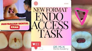 NEW FORMAT! ENDODONTIC ACCESS TASK ADC EXAM