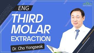 [ENG] Third Molar Extraction - [Dr. Cho Yongseok]