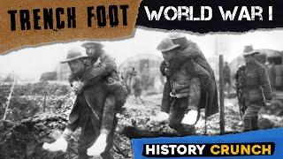 Trench Foot in World War 1 - Video Infographic