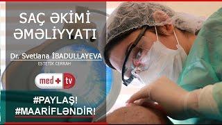 SAÇ TOKULMESİ - SAÇ EKİMİ - DR. Svetlana İBADULLAYEVA Estetik Cerrah MedplusTV