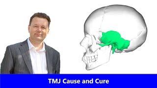 TMJ Cause and Cure Explained with self help tips by Dr Marcus Spry