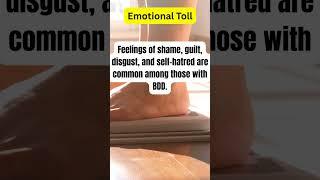 BDD: The Pain You Can't See!