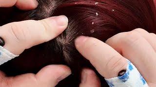 Silent ASMR Scalp Care: Gentle Exfoliation & Dandruff Removal (No Talking)