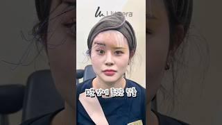 졸린눈 리프팅 이거 맞아요..?