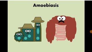 Entamoeba histolytica (Amoebiasis) الأميبا / الدوسنتاريا