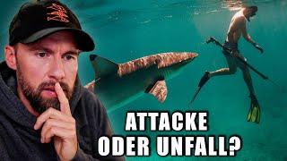 16-year-old shark attack