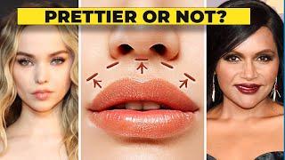 The Lip Lift: BEAUTIFYING Procedure or Scam?