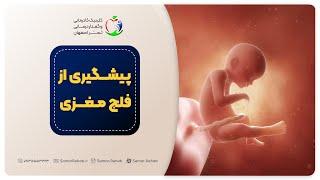 راه های پیشگیری از فلج مغزی (CP)