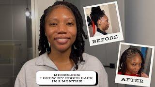 HOW I GREW MY EDGES BACK IN TWO MONTHS! | MINOXIDIL + MICROLOCS | MICROLOCS JOURNEY