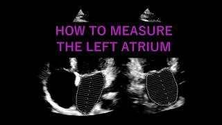 Measuring the LEFT ATRIUM VOLUME: Echocardiography